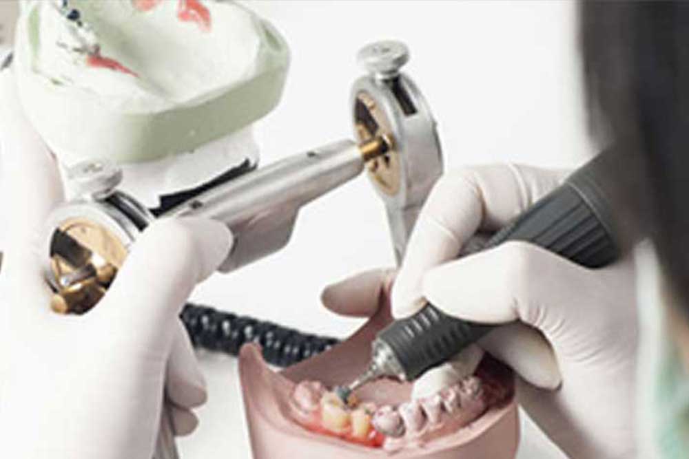 歯科医師と歯科技工士